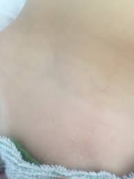 Mar 16, 2017 at 1:59 pm. Pubic Hair On Children Babycenter