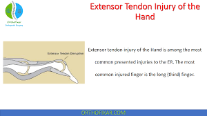 Image result for Elson Extensor Tendon Test