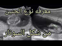 متى يبان نوع الجنين الولد