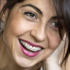 How Long Do Braces Take? What to Expect from Adult Orthodontia