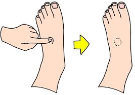 Image result for Edema Exam
