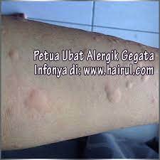Hal ini memang wajar, karena virus flu maupun batuk bisa tersebar di mana saja dan kapan saja. Ubat Gegata Tradisional Berubat T