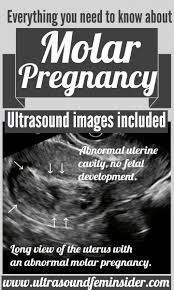 Pin On Pregnancy Guide