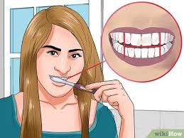 Dental professionals recommend brushing your teeth for two minutes, twice daily. How To Clean Teeth With Braces 12 Steps With Pictures Wikihow