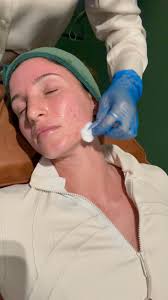 Back for round 2 at the @the_skinbar loving the results for my skin! 4  weeks between treatments and I’ve noticed less break outs and more  resilience to my skin. Keen for my 3rd treatment with the ...