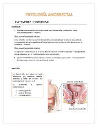 Maybe you would like to learn more about one of these? Patologia Hemorroides Gastroenterologia