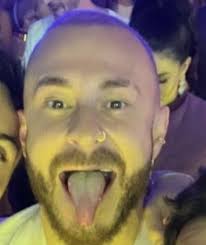 Foto: Ex-BBB Fred Bruno chamou atenção em foto de aniversário pela  aparência esbranquiçada da língua