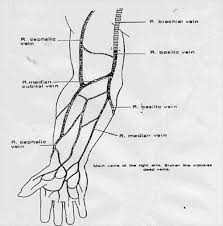 Image result for Difficult Intravenous Access in Children