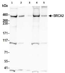 Image result for BRCA2