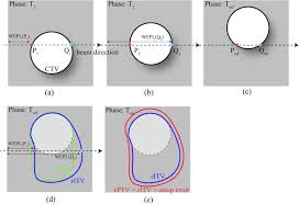 Through liver diagram we can also understand the liver anatomy and liver structure clearly. Four Dimensional Carbon Ion Pencil Beam Treatment Planning Comparison Between Robust Optimization And Range Adapted Internal Target Volume For Respiratory Gated Liver And Lung Treatment Physica Medica European Journal Of Medical Physics