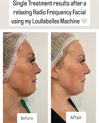 Elles Body Contouring Aesthetics