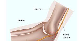 Compressione Del Nervo Ulnare Al Gomito Centro Prevenzione Donna