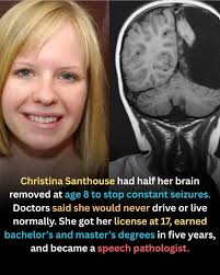 me clarify this as IT IS EPILEPSY" parent whose children "only have  Epilepsy" "just" Epilepsy with limited child's goes having seizures. they  exhaustion parent who hasn't their both child starting eaten sitting