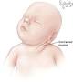 Image result for ‫کوتاه بودن استخوانهای بلند جنین‬‎
