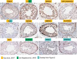 Open access volumetric atlas offering comprehensive anatomical delineations of the rat brain based on the latest atlas version contains 118 structures, intended as a basis for further development by. Representative Human Protein Atlas Examples Of Spg Markers Filtered Download Scientific Diagram