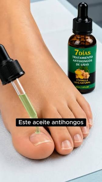Seguramente has visto estos parches chinos que prometen curar hongos en las uñas en pocos días. Pero la realidad es que los hongos ungueales no se eliminan desde afuera. La uña es