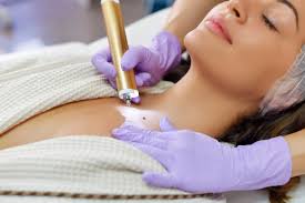 Usuwanie pieprzyków – wskazania, przebieg zabiegu i efekty - HelloZdrowie