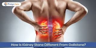 How Is Kidney Stone Different From Gallstone Pristyn Care