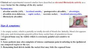 Image result for Alveolitis sicca)