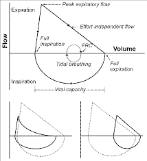 Flow Volume Loops The Upper Panel Shows A Typical Flow Volume Loop And Download Scientific Diagram