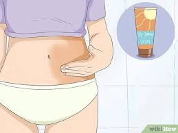 In this video, daniel gives you 3 tips to get rid of stretch marks on your body. 3 Ways To Get Rid Of Stretch Marks At Home Wikihow