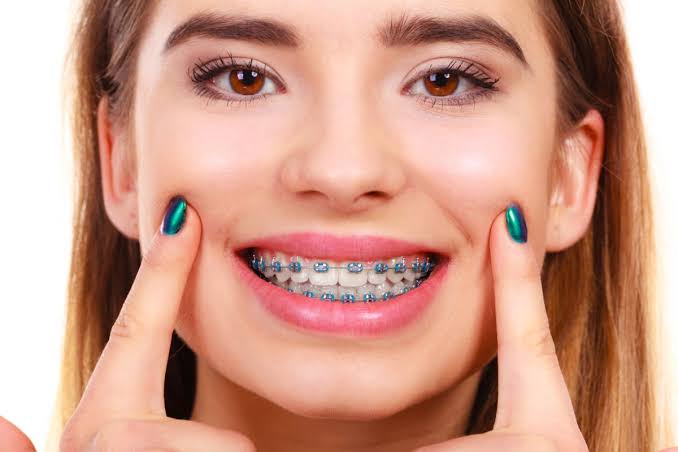 Everything You Need To Know About Smile Arc Protection - Smile Patio