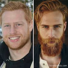 Absence of facial hair in a guy of 26 is a genuine cause for concern. 30 Before After Pics That Will Make You Reconsider Shaving Your Beard Bored Panda