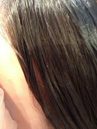 Nits On Hair Strand Hair African American Hairstyles Model Hair