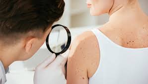 Dar pentru cei din jur putem reprezenta un bolile pe care le provoacă stafilococul auriu în gât. Foliculita Cauze Simptome Si Tratament Ce Masuri Sa Iei Ca Sa O Previi Reginamaria Ro