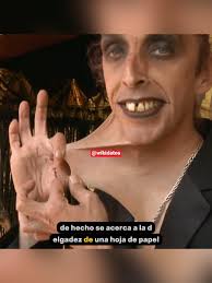 Sindrome De Turner En Famosos