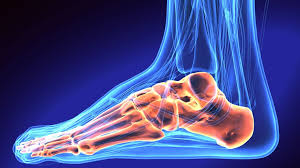 Avulsion fractures can be confused with other types of fractures to the fifth metatarsal bone. Avulsion Fracture Of The Ankle Symptoms Causes Treatments Surgery Recovery