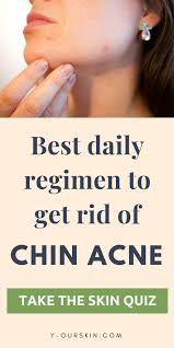 Best Daily Regimen To Get Rid Of Chin Acne Take The Skin Quiz To Get Your Personalized Skin Care System Skin Quiz Chin Acne Skin Care System