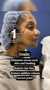 A look inside the OR with Dr. Christopher Fleury! Get an exclusive peek at  the precision, passion, & artistry that goes into transforming lives. From  providing exceptional care & going far beyond