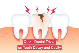 There are multiple stages, most of which require you to heal before you can move on to the next stage. Quiz Dental Trivia On Tooth Decay And Cavity Stemjar