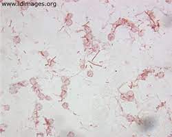 Important properties of salmonella species. Salmonella Images Infectious Disease Images Emicrobes Digital Library Atlas