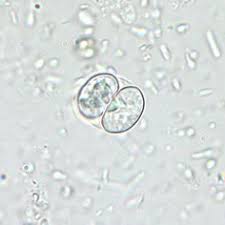 Where can you find protozoans in fresh water? 34 Protozoa Ideas Microbiology Parasite Medical Laboratory