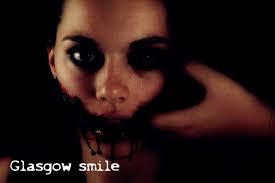 Glasgow smile, chelsea grin, chelsea smile) — раны на лице, наносимые ножом или другим острым предметом от уголков рта и почти до ушей. Ulybka Glazgo Nik Karapetyan Stihi Ru
