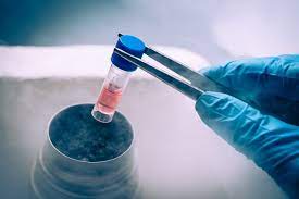 Limfocite t cd4 (numite helper sau auxiliare), care secretă citokine sau interleukine (molecule care le ajută să coopereze cu alte celule) Limfocite ScÄzute La Copil Qbebe Ro