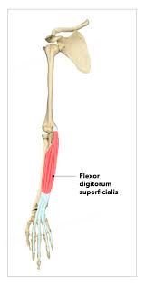 Maybe you would like to learn more about one of these? Figure Flexor Digitorum Superficialis Statpearls Publishing Illustration Statpearls Ncbi Bookshelf