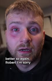 Attacked By Robert The Doll