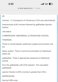 Image result for HIDA Scan