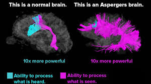 Their problems are mainly social. I M Programmer Do I Have Asperger S Syndrome Work N Me
