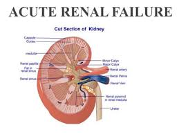 Семидоцька жана дмитрівна — професор кафедри. Acute Renal Failure Causes And Symptoms