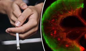 Smoking can cause Crohn's which brings misery to thousands ...