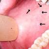 The desquamation when present is finer than in either measles or scarlet fever. Https Encrypted Tbn0 Gstatic Com Images Q Tbn And9gctbbg0qijo93etxgkd1kkdum0con Uxiiiye Rxstqsyz9q3k4n Usqp Cau
