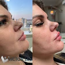 Dr. Victor Leli Placciti (@drvictorleli) • Instagram photos and videos