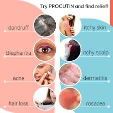 Image result for demodex rosacea