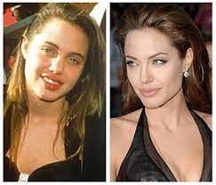 Actress angelina jolie announced today that she underwent a preventative double mastectomy after learning she is at a high risk of developing breast cancer. Angelina Jolie Plastic Surgery At This Moment People Are Flickr