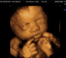 4d ultrasound pictures 36 weeks. Hd Ultrasound Photo Boston Massachusetts