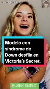 Sindrome De Modelo Que Es